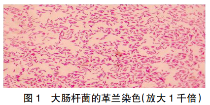 山东滨州鸡大肠杆菌分离鉴定及耐药性分析