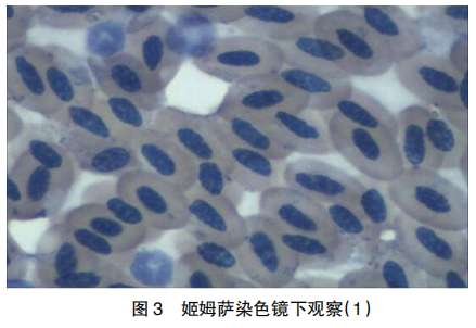 3 例禽霍乱临床诊断