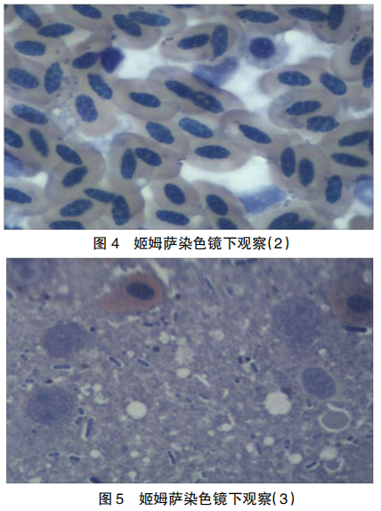 3 例禽霍乱临床诊断