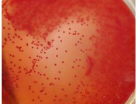 鸽大肠杆菌病的诊断与防治