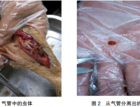 1例鸭舟形嗜气管吸虫病诊断与治疗