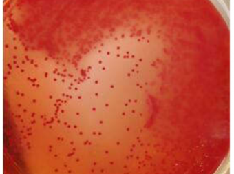 鸽大肠杆菌病的诊断与防治