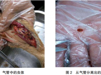 1例鸭舟形嗜气管吸虫病诊断与治疗